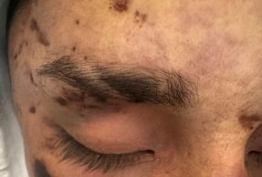 Chile criminal: Carabineros habría asesinado a golpes a joven detenido