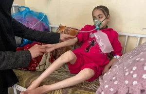 Hechos – Israel en Gaza: 25% de los niños están desnutridos