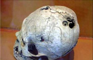 Neurocirugía ancestral: Cuando los Paracas operaban cerebros con más éxito que la medicina del siglo XIX