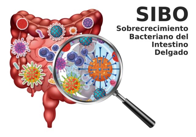 sobrecrecimiento-bacteriano-intestino-delgado